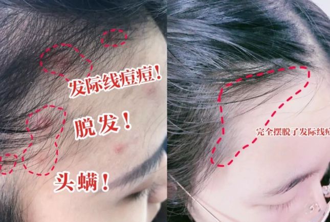 冬洗头干发神器！养出女明星绸缎发！不朽情缘正版国产变态“抽水帽”入(图10)